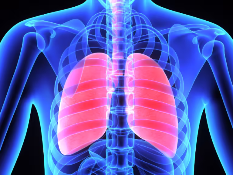 Radiografie pulmonară evidențiind starea plămânilor